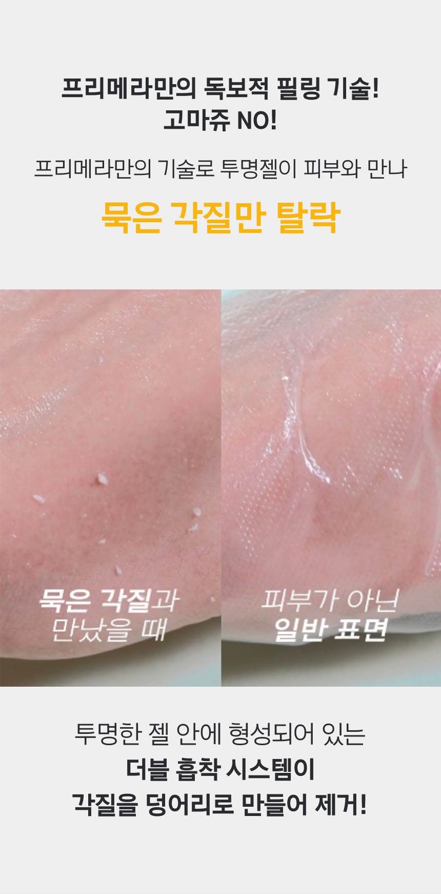 프리메라만의 독보적 필링 기술! 고마쥬 NO! 프리메라만의 기술로 투명젤이 피부와 만나 묵은 각질만 탈락, 묵은 각질과 만났을 때 VS 피부가 아닌 일반 표면, 투명한 젤 안에 형성되어 있는 더블 흡착 시스템이 각질을 덩어리로 만들어 제거!