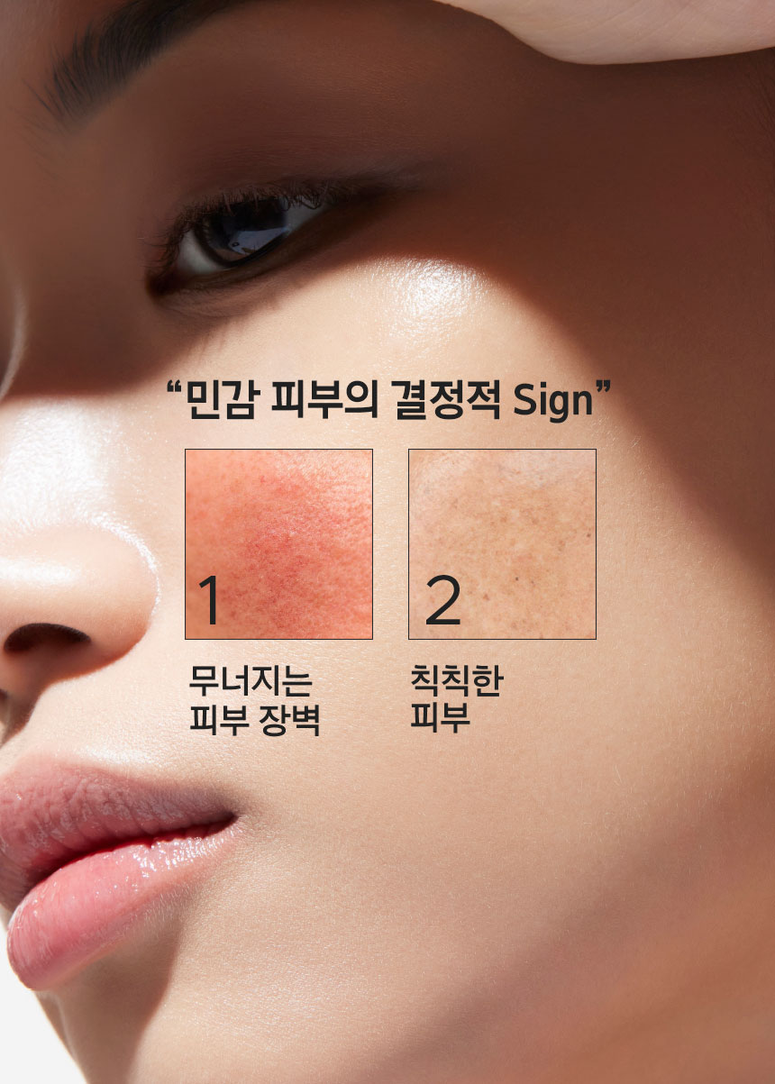 “민감 피부의 결정적 Sign 1.무너지는 피부 장벽 2.칙칙한 피부